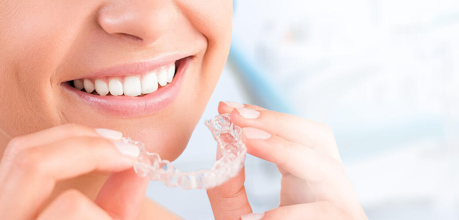 Clear Aligner in Ahmedabad