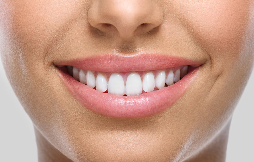 Teeth Cleaning
