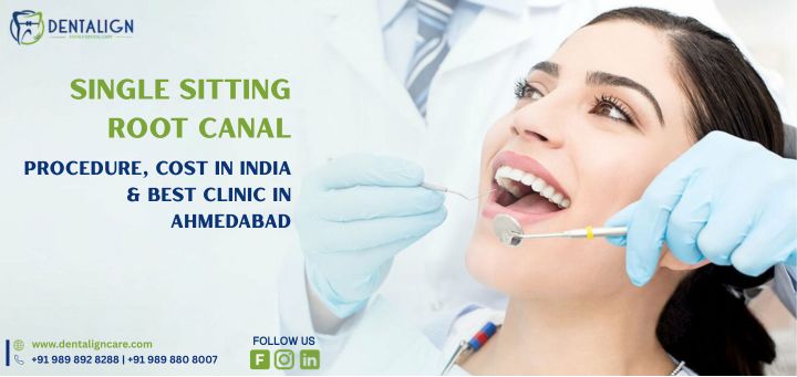 Single Sitting Root Canal Procedure, Cost in India & Best Clinics in Ahmedabad