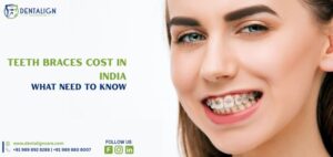 Teeth Braces Cost in India