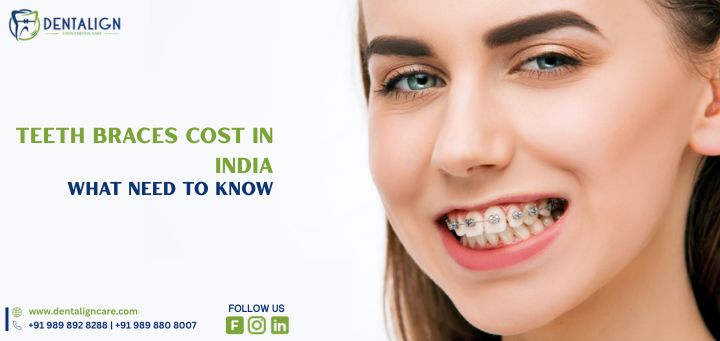Teeth Braces Cost in India