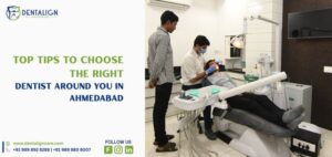 Top Tips to Choose the Right Dentist Around You in Ahmedabad