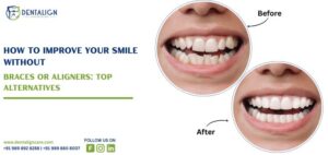 How to Improve Your Smile Without Braces or Aligners: Top Alternatives