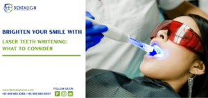 Brighten Your Smile with Laser Teeth Whitening What to Consider