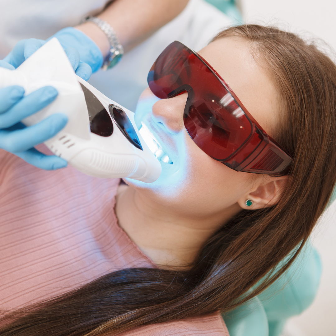 Teeth After Laser Whitening