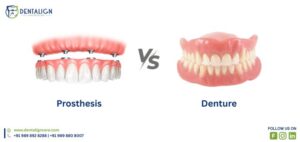 What is the difference between a prosthesis and a denture