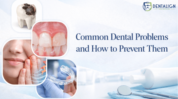 Common Dental Problems and How to Prevent Them