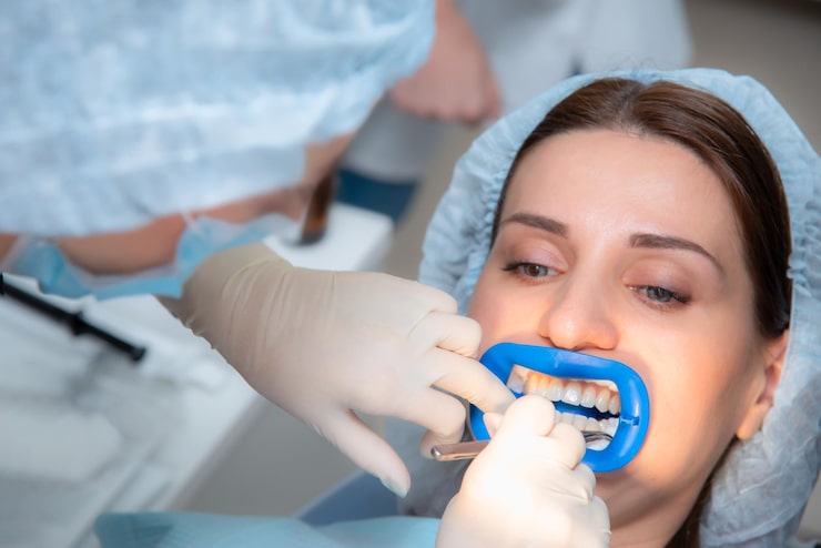 dental alignment treatments